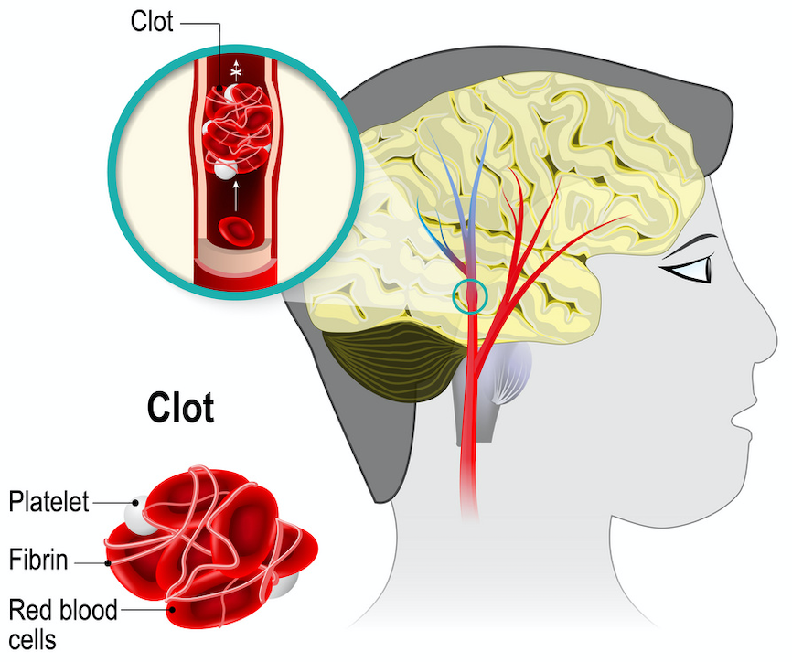 1599527822911537.png 08-2.png